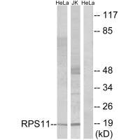 Western blot analysis of extracts from HeLa cells and Jurkat cells, using RPS11 antibody.