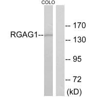 Western blot analysis of extracts from COLO cells, using RGAG1 antibody.
