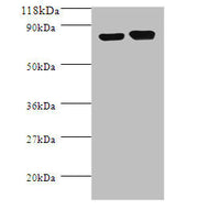 Western blot All lanes: Lysine decarboxylase, constitutive antibody at 2ug/ml + DH5a whole cell lysate Secondary Goat polyclonal to rabbit IgG at 1/10000 dilution Predicted band size: 81 kDa Observed band size: 81 kDa