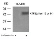 Western blot analysis of extracts from Huvec cells untreated or treated with Anisomycin using ATF2(Phospho-Ser112 or 94) Antibody.
