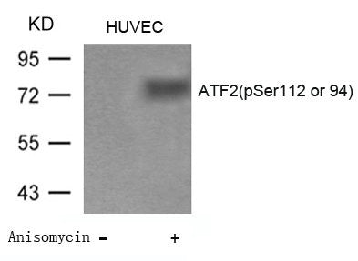 Western blot analysis of extracts from Huvec cells untreated or treated with Anisomycin using ATF2(Phospho-Ser112 or 94) Antibody.