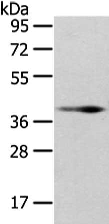 Gel: 8%SDS-PAGE, Lysate: 40 ug, Lane: Human fetal muscle tissue, Primary antibody: CSB-PA164068(WNT10B Antibody) at dilution 1/200 dilution, Secondary antibody: Goat anti rabbit IgG at 1/8000 dilution, Exposure time: 10 seconds