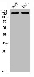 Western Blot analysis of 293T Hela cells using Collagen I Polyclonal Antibody diluted at 1:500. Secondary antibody was diluted at 1:20000