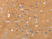 The image on the left is immunohistochemistry of paraffin-embedded Human brain tissue using CSB-PA164401(JAK2 Antibody) at dilution 1/35, on the right is treated with synthetic peptide. (Original magnification: ×200)