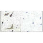 Immunohistochemical analysis of paraffin-embedded human brain tissue using COX1 antibody.