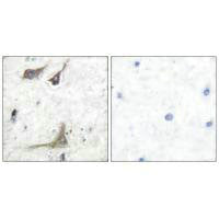 Immunohistochemical analysis of paraffin-embedded human brain tissue using COX1 antibody.