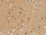 The image on the left is immunohistochemistry of paraffin-embedded Human brain tissue using CSB-PA165026(SIAH2 Antibody) at dilution 1/20, on the right is treated with synthetic peptide. (Original magnification: ×200)