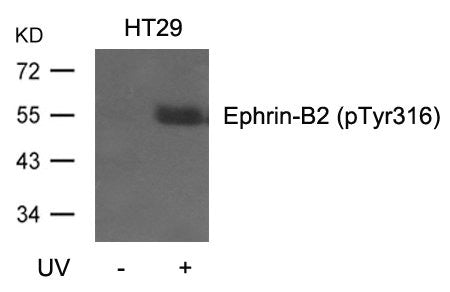 Western blot analysis of extracts from HT29 cells, untreated or treated with UV using Ephrin-B2(Phospho-Tyr316) Antibody.