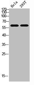 Western Blot analysis of HELA, 293t cells using Antibody diluted at 800. Secondary antibody was diluted at 1:20000