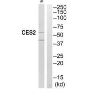 Western blot analysis of extracts from Jurkat cells, using CES2 antibody.
