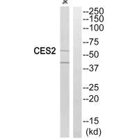 Western blot analysis of extracts from Jurkat cells, using CES2 antibody.