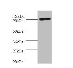 Western blot All lanes: Aquaticus DNA polymerase I, thermostable antibody at 2ug/ml + 293T whole cell lysate Secondary Goat polyclonal to rabbit IgG at 1/10000 dilution Predicted band size: 94 kDa Observed band size: 94 kDa