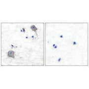 Immunohistochemical analysis of paraffin-embedded human brain tissue using Claudin 5 antibody.
