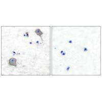 Immunohistochemical analysis of paraffin-embedded human brain tissue using Claudin 5 antibody.