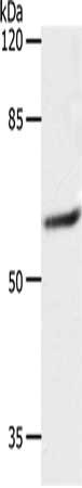 Gel: 10%SDS-PAGE, Lysate: 40 ug, Lane: 231 cells, Primary antibody: CSB-PA167086(SLC16A4 Antibody) at dilution 1/1200, Secondary antibody: Goat anti rabbit IgG at 1/8000 dilution, Exposure time: 10 seconds