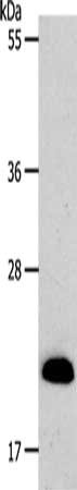 Gel: 10%SDS-PAGE, Lysate: 40 ug, Lane: Mouse heart tissue, Primary antibody: CSB-PA167144(SIRT5 Antibody) at dilution 1/500, Secondary antibody: Goat anti rabbit IgG at 1/8000 dilution, Exposure time: 10 seconds