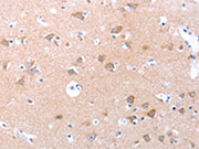The image on the left is immunohistochemistry of paraffin-embedded Human brain tissue using CSB-PA167385(SPAG4 Antibody) at dilution 1/30, on the right is treated with synthetic peptide. (Original magnification: ×200)