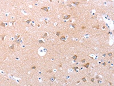 The image on the left is immunohistochemistry of paraffin-embedded Human brain tissue using CSB-PA167385(SPAG4 Antibody) at dilution 1/30, on the right is treated with synthetic peptide. (Original magnification: ×200)