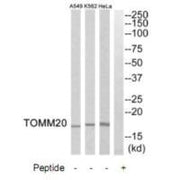 Western blot analysis of extracts from HeLa cells, K562 cells and A549 cells, using TOMM20 antibody.