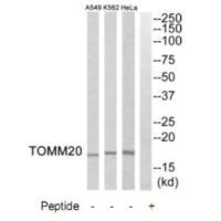 Western blot analysis of extracts from HeLa cells, K562 cells and A549 cells, using TOMM20 antibody.