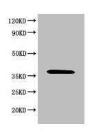 Western Blot Positive WB detected in: 293T whole cell lysate All lanes: MAPK8 antibody at 6µg/ml Secondary Goat polyclonal to rabbit IgG at 1/50000 dilution Predicted band size: 49, 45, 36 KDa Observed band size: 36 KDa