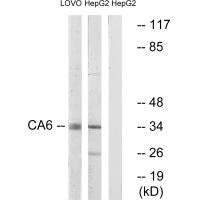 Western blot analysis of extracts from LOVO cells and HepG2 cells, using CA6 antibody.