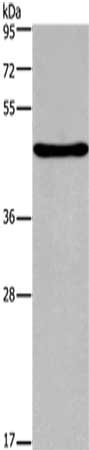 Gel: 8%SDS-PAGE,Lysate: 40ug,Primary antibody: CSB-PA167678(FOXA2 Antibody) at dilution 1/500 dilution,Secondary antibody: Goat anti rabbit IgG at 1/8000 dilution,Exposure time: 3 minutes
