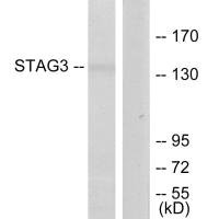 Western blot analysis of extracts from Jurkat cells, using STAG3 antibody.
