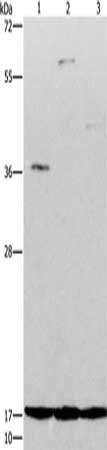 Gel: 12%SDS-PAGE, Lysate: 50 ug, Lane 1-3: 293T cells, SP20 cells, human fetal liver tissue, Primary antibody: CSB-PA167947(ARTN Antibody) at dilution 1/350, Secondary antibody: Goat anti rabbit IgG at 1/8000 dilution, Exposure time: 2 minutes