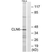 Western blot analysis of extracts from HeLa cells, using CLN6 antibody.