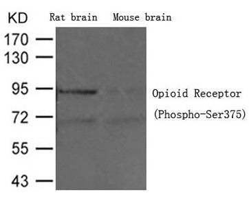 Western blot analysis of extracts from Rat brain tissue and Mouse brain tissue using Opioid Receptor (Phospho-Ser375) Antibody.