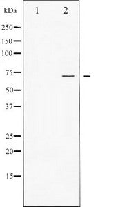 Western blot analysis of FOXO1A expression in Serum treated HeLa whole cell lysates,The lane on the left is treated with the antigen-specific peptide