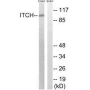 Western blot analysis of extracts from mouse brain cells, using ITCH (Ab-420) antibody.