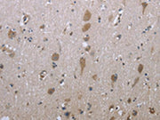 The image on the left is immunohistochemistry of paraffin-embedded Human brain tissue using CSB-PA169061(GPC6 Antibody) at dilution 1/40, on the right is treated with fusion protein. (Original magnification: ×200)