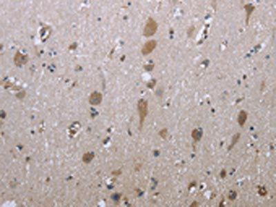 The image on the left is immunohistochemistry of paraffin-embedded Human brain tissue using CSB-PA169061(GPC6 Antibody) at dilution 1/40, on the right is treated with fusion protein. (Original magnification: ×200)