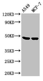Western Blot Positive WB detected in: A549 whole cell lysate, MCF-7 whole cell lysate All lanes: LOX antibody at 3.6µg/ml Secondary Goat polyclonal to rabbit IgG at 1/50000 dilution Predicted band size: 47 kDa Observed band size: 47 kDa