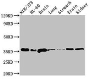 Western Blot Positive WB detected in: NIH/3T3 whole cell lysate, HL60 whole cell lysate, Rat brain tissue, Rat lung tissue, Rat stomach tissue, Mouse brain tissue, Mouse kidney tissue All lanes: JUN antibody at 3µg/ml Secondary Goat polyclonal to...