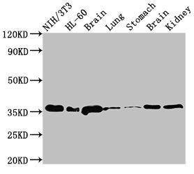 Western Blot Positive WB detected in: NIH/3T3 whole cell lysate, HL60 whole cell lysate, Rat brain tissue, Rat lung tissue, Rat stomach tissue, Mouse brain tissue, Mouse kidney tissue All lanes: JUN antibody at 3µg/ml Secondary Goat polyclonal to...