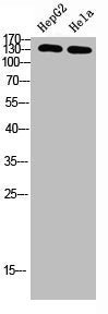 Western Blot analysis of HEPG2, HELA cells using Antibody diluted at 500. Secondary antibody was diluted at 1:20000