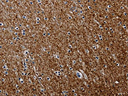 The image on the left is immunohistochemistry of paraffin-embedded Human brain tissue using CSB-PA169703(PCDHAC1 Antibody) at dilution 1/50, on the right is treated with synthetic peptide. (Original magnification: ×200)
