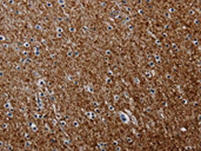 The image on the left is immunohistochemistry of paraffin-embedded Human brain tissue using CSB-PA169703(PCDHAC1 Antibody) at dilution 1/50, on the right is treated with synthetic peptide. (Original magnification: ×200)