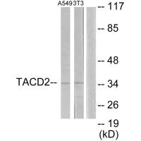 Western blot analysis of extracts from A549 cells and NIH-3T3 cells, using TACD2 antibody.
