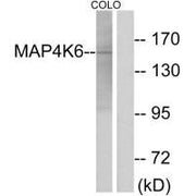 Western blot analysis of extracts from COLO cells, using MAP4K6 antibody.