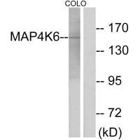 Western blot analysis of extracts from COLO cells, using MAP4K6 antibody.
