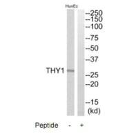Western blot analysis of extracts from HuvEc cells, using THY1 antibody.