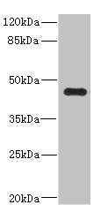 Western blot All lanes: Ren2 antibody at 2µg/ml + MCF-7 whole cell lysate Secondary Goat polyclonal to rabbit IgG at 1/10000 dilution Predicted band size: 45 kDa Observed band size: 45 kDa