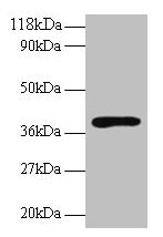 Western blot All lanes: Hp antibody at 2µg/ml + Rat live tissue Secondary Goat polyclonal to rabbit IgG at 1/10000 dilution Predicted band size: 39, 43 kDa Observed band size: 39 kDa