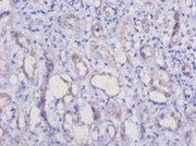 Immunohistochemistry of paraffin-embedded human kidney tissue using CSB-PA17109A0Rb at dilution of 1:50
