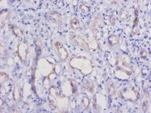 Immunohistochemistry of paraffin-embedded human kidney tissue using CSB-PA17109A0Rb at dilution of 1:50