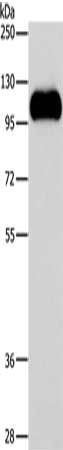 Gel: 8%SDS-PAGE, Lysate: 40 ug, Lane: Raji cells, Primary antibody: CSB-PA171110(STAT6 Antibody) at dilution 1/250, Secondary antibody: Goat anti rabbit IgG at 1/8000 dilution, Exposure time: 5 seconds